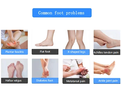 Revolutionizing Foot Care: Xianku’s 3D Foot Scanner Transforms Orthopedics And Foot Health