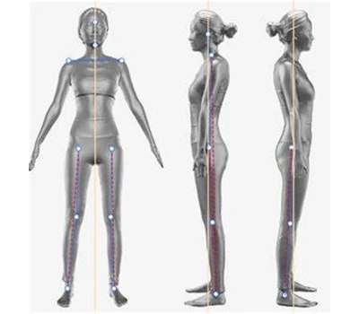 Forward Head Posture, Pelvic Tilt, And You: How 3D Body Scanner Enables Scientific Posture Correc...